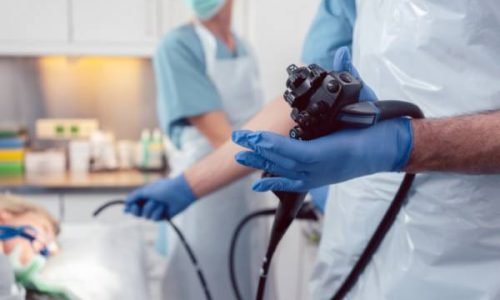 Endoscopy