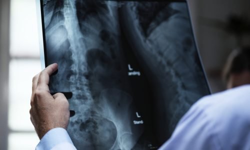 A doctor with a patient's x-ray film